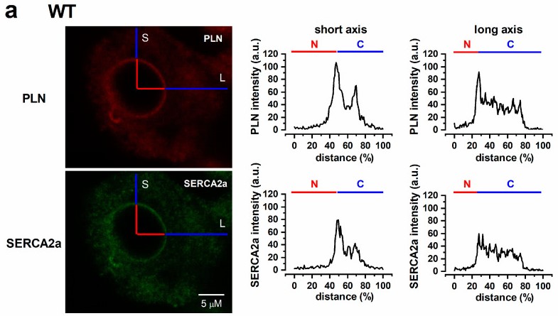 Subcellular PLN and SERCA2a localization in WT.jpg